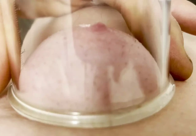 Nipple sucker