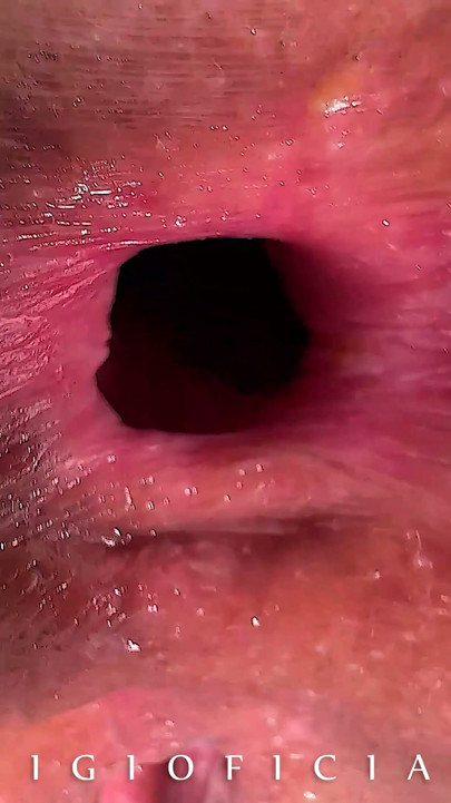 Fuck! I farted in my boyfriend’s nose 👃 But he enjoyed it! | Clip 1