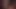 Xordel Intense Anal Masturbation Delicious Big Ass Playing with Anal Balls Sweet Intense Pleasure Gaping Anus Tasty Fucking