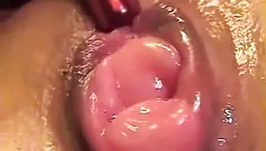 Prolapsed Asian Pussy Squirting