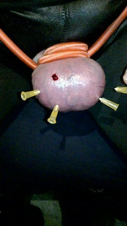 needles in balls