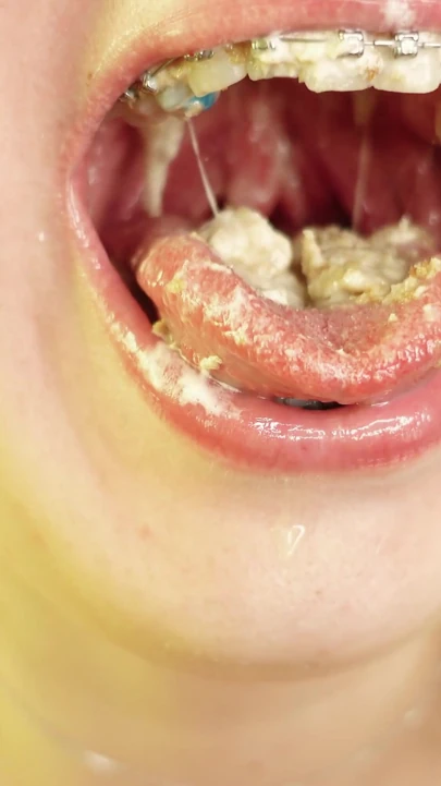 eating in braces - vore and food fetish - close up video | Clip 3