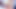 Interracial Anal: 30cm Black Cock in Tight White Ass - Extreme Contrasts