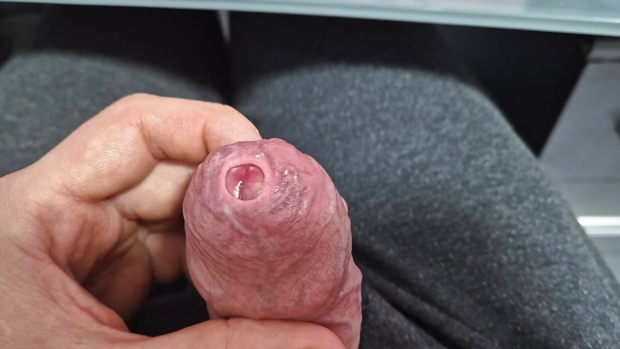 Neporezana Uska Fimoza Kurac Precum Zavodljivanje za Ljubitelje Prepucija S Izbacivanjem Sperme