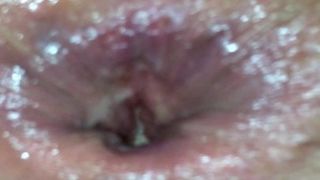 my ex nypho slut anal portuges