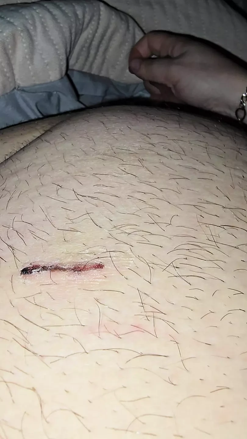 Step mom help injured step son with low erection with a handjob