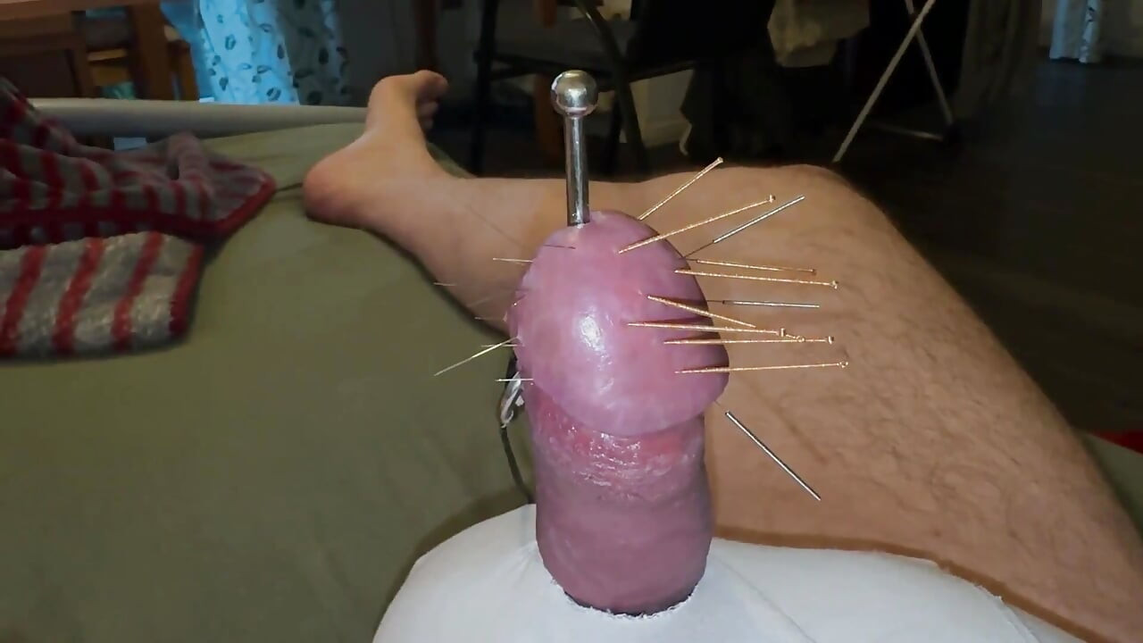 Akupunktur - Orgazm!