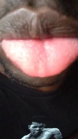 My Tongue Full of Welch Fruit Snack.