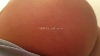 My hip