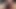 Masturbation extreme an der Eichel mit Nobra Twincharger xxx