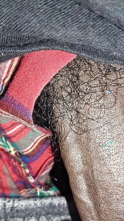 Close up on These Thick Veins