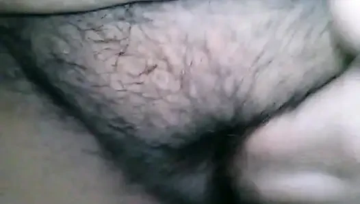 My hairy