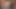 My Screaming Painful Begging Anal With Creampie