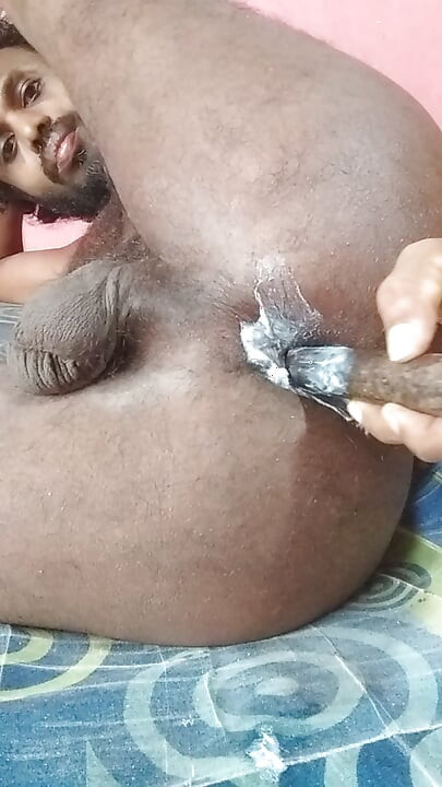 Inserting an iron into the rectum