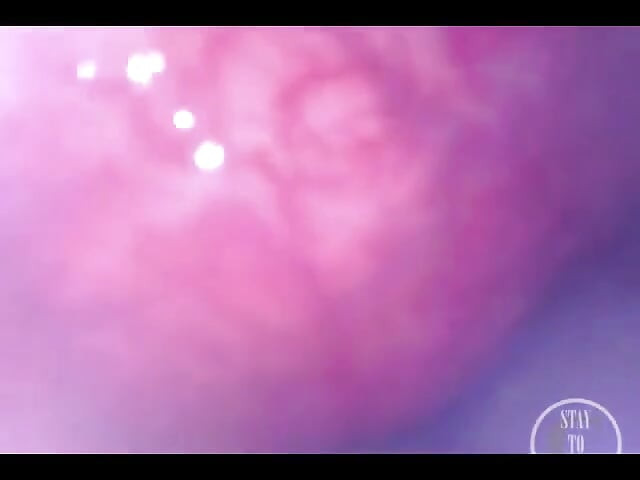 POV extrem tiefe anal-untersuchung!
