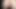 Teen Acne Gloryhole Red Faced Cunt Creampies N Swallowing Spunk Red Head Penis Suck N Fuck