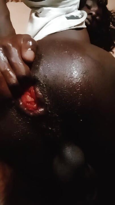 Fisting Black Ass and Prolapse