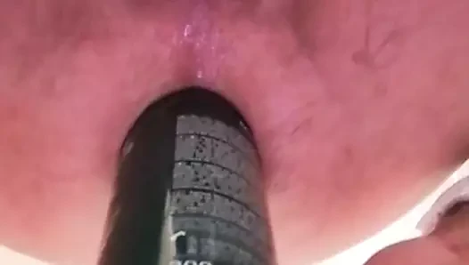 anal