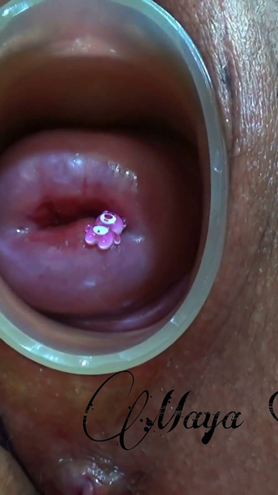 I Show You My Healthy Cervix and an Orgasm