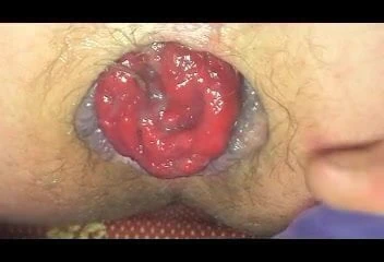 fisting anal dildo toy man gay ladyboy fetish cock