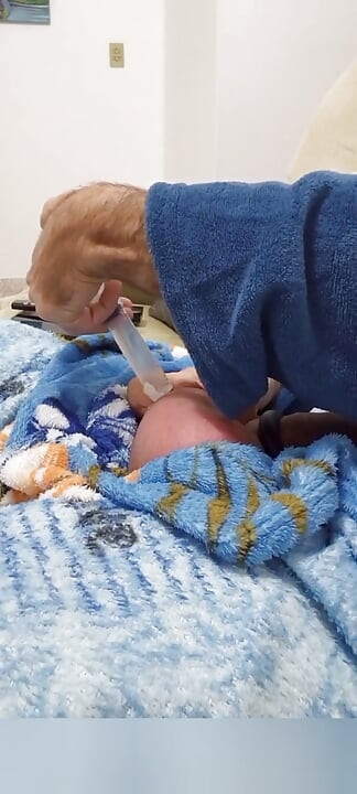 60cc Saline Injection in Each Egg