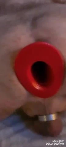 Anal Tunel