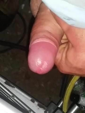 Abspritzen3