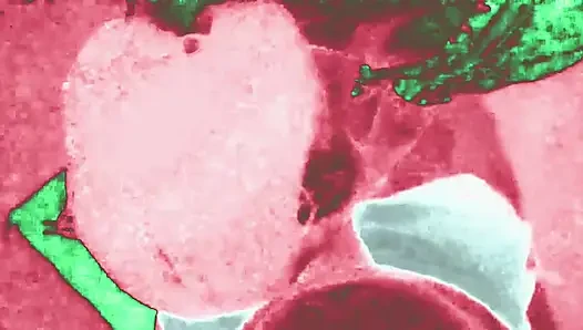 I made a video of my sister-in-law's leg.