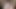 私は無脳です