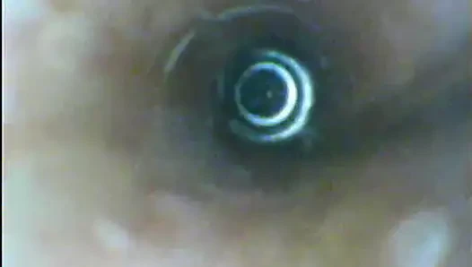 endoscope peehole cumflow