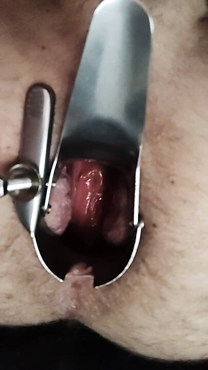 Open ass