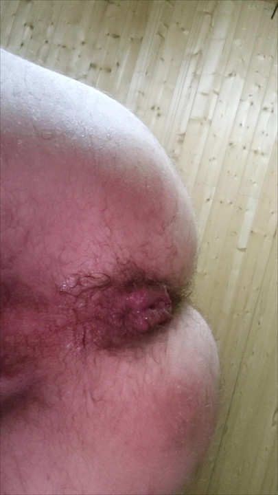 Anal close-up