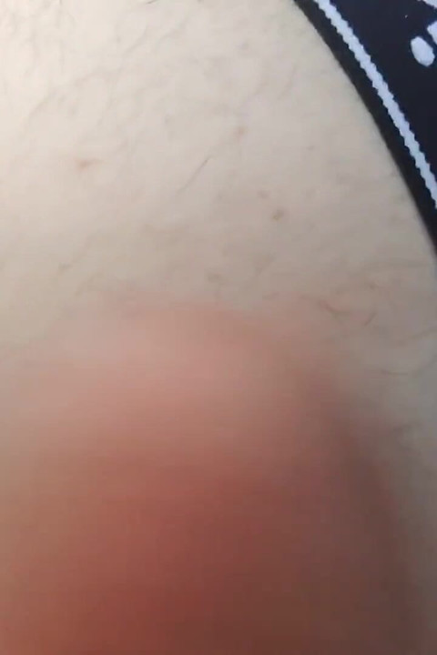 Pišanje na kurac