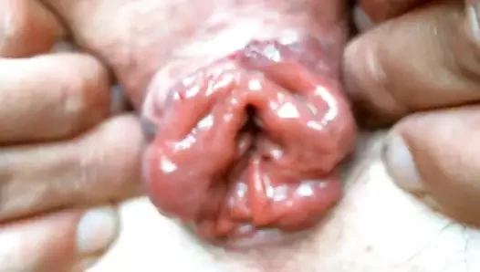 Olibrius71 prolapsus anal
