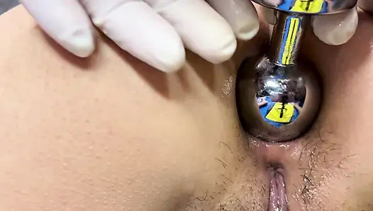 Enlarging my wife's anus to 4cm