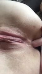 anus