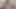 lizzy yum July 2023 JUST gas ME Post-op Orgasm Pussy Clit Masturbation Teasing Orgasm
