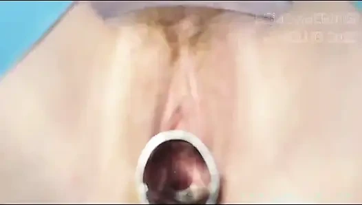 Sert jinekoz orgazmı