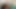 ممرضة التنقيط جين كاميرون تهزه للحصول على عينة