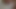 Lizzy Yum VR MAY 2023 JUST ME #2 post op orgasm pussy anal masturbation teasing orgasm