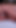 "Orta yaşlı seksi kadın melken am besten"den ağzı açık bırakma anı