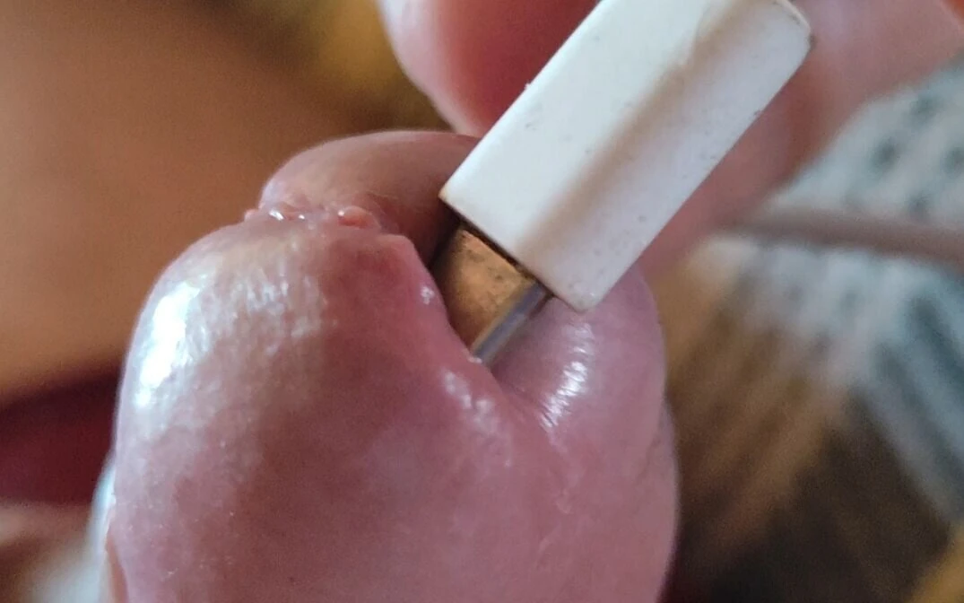 Applying Electric Shocks Inside the Glans.
