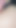 Jaw-dropping moment from "Extreme Tight 18 Ass Vs My First Big Cock - Distroy My Ass For The First Time ( Add Me Free Nudes )"