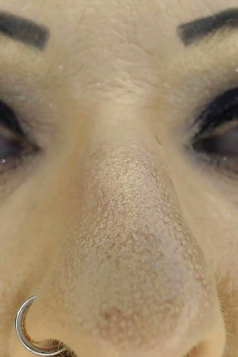 Omg Aging Sucks All Facial Wrinkles