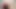 A huge anal prolapse fell out of the anus of a young guy after fucking with a monstrous dildo