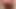 My Implanted and silicone enlarged ridiculous cock.