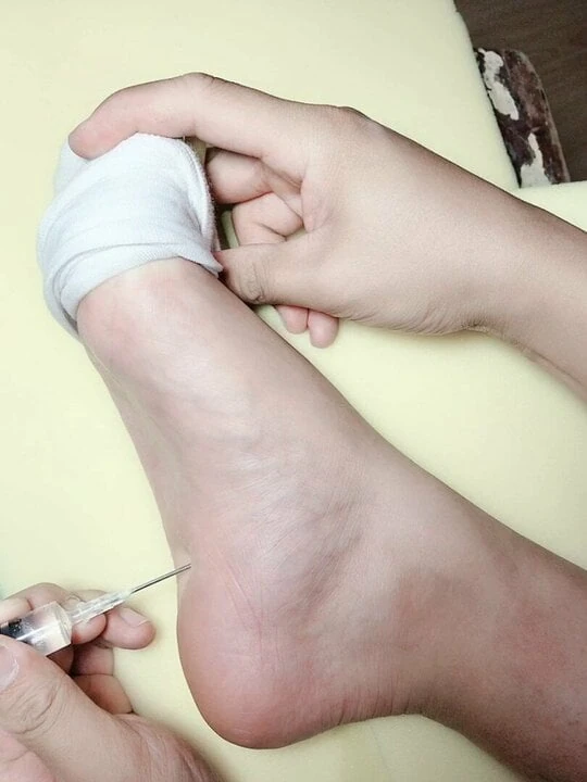 tortured feet