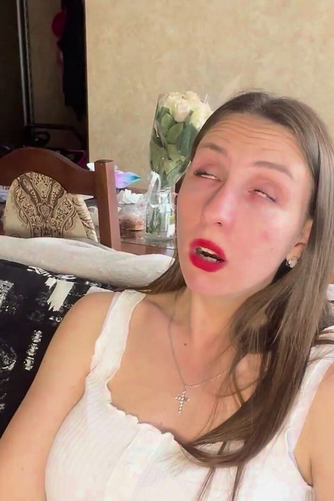Yawning Fit Uvulia Show