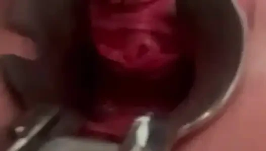 Ich und mein spekulus