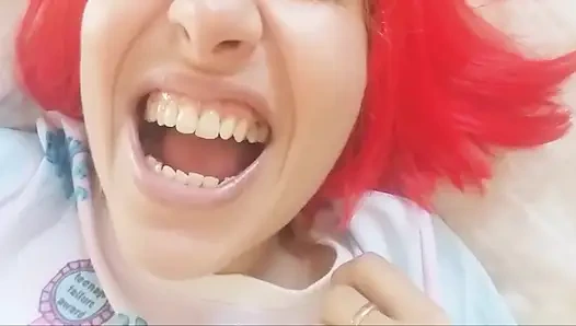 Chantal'ın dişleri çürümüş ve siyah dökülüyor